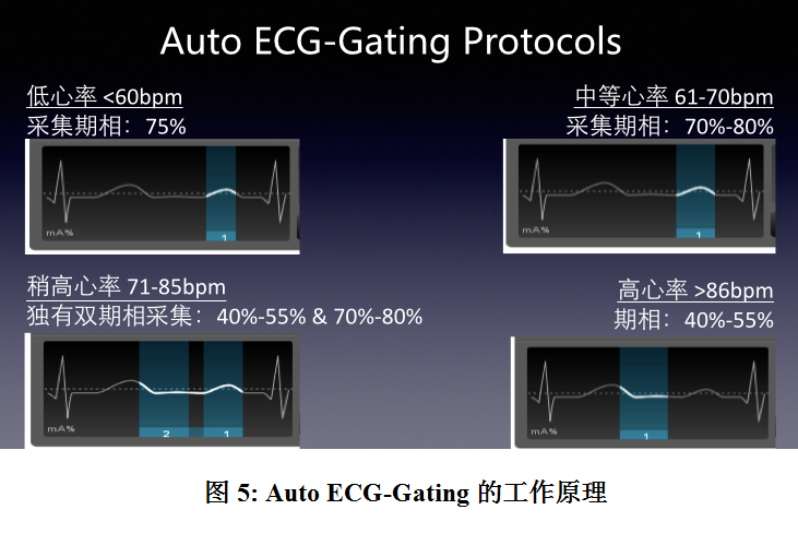 下,在一个心动周期内完成对心脏的采样,还需要配备智能的心电门控装置