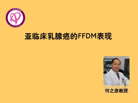 亚临床乳腺癌的FFDM表现