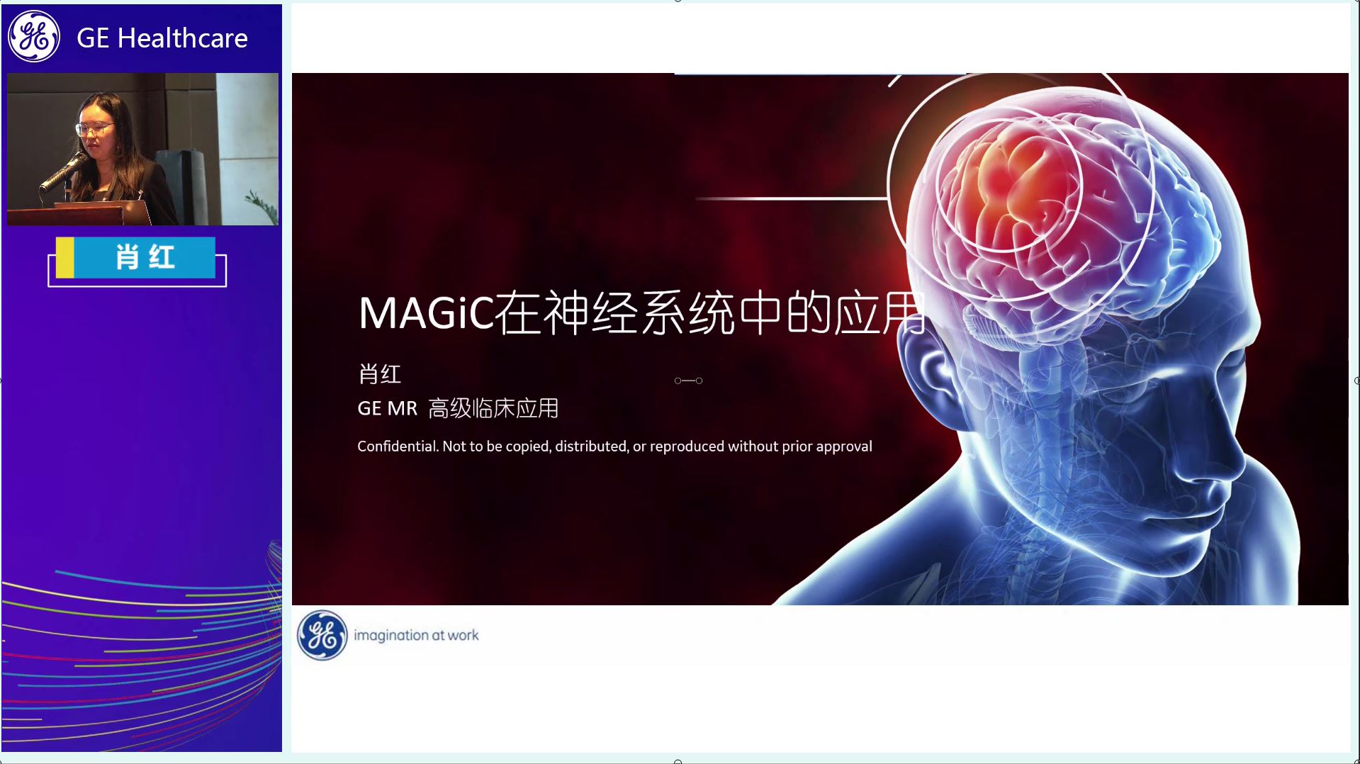 MAGiC成像在中枢神经中的应用
