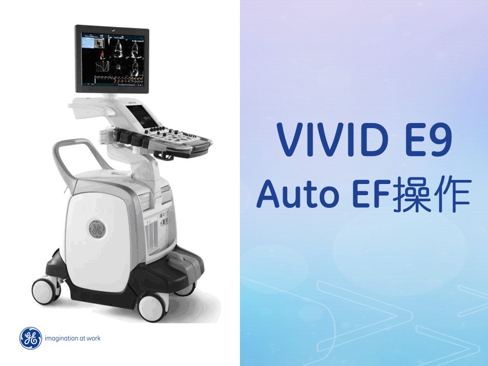 Vivid E9 Auto EF操作