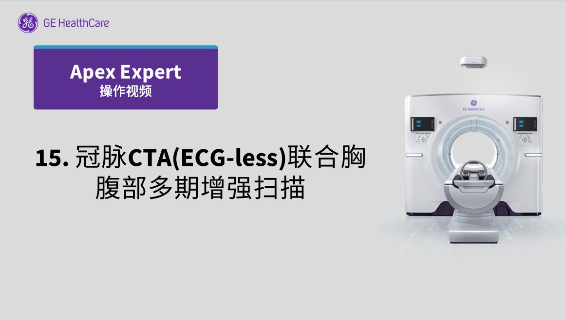 15.冠脉CTA(ECG-less)联合胸腹部多期增强扫描