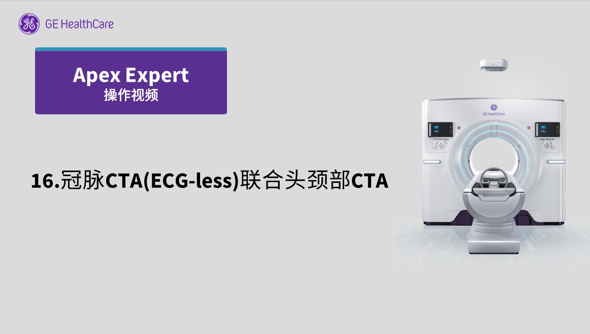 16.冠脉CTA(ECG-less)联合头颈部CTA