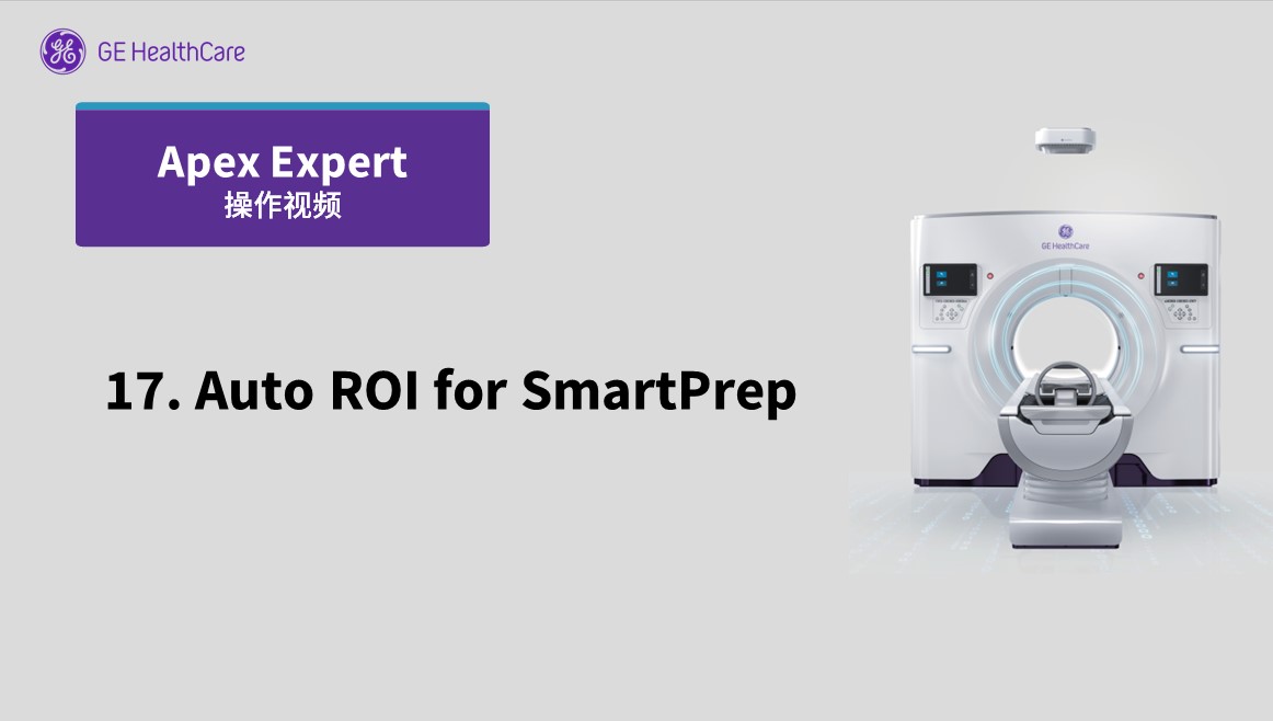 17.Auto ROI for SmartPrep