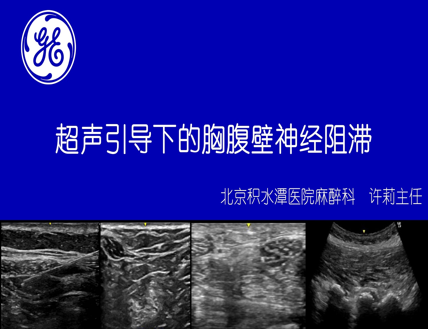 超声云课堂订阅栏目活动时间:2017-11-09活动地址:超声名家半月谈活动