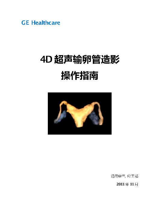 4D输卵管造影指南