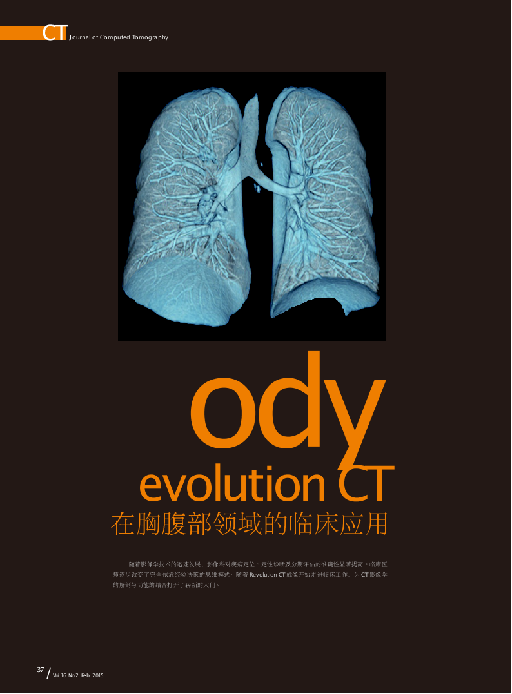 Revolution <i>CT</i>在胸腹部领域的<i>临床</i><i>应用</i>