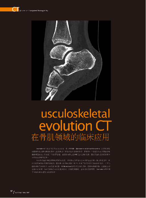 Revolution CT在骨肌领域的临床应用