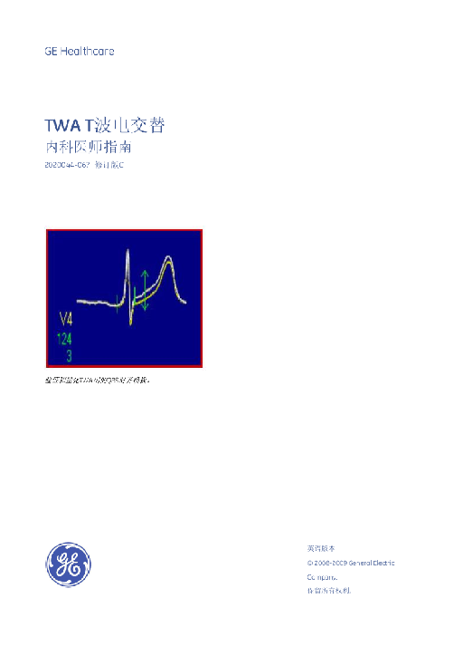 TWA T波电交替   内科医师指南