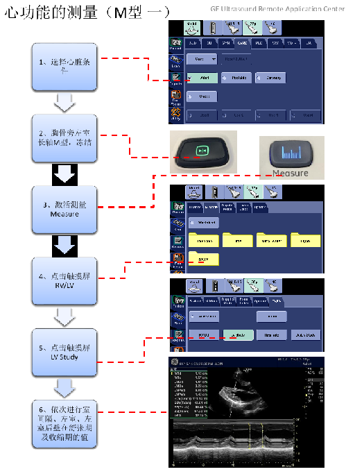 LOGIQ C9 M型测量心功能的步骤