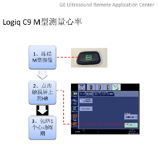 LOGIQ C9 M型测心率的步骤